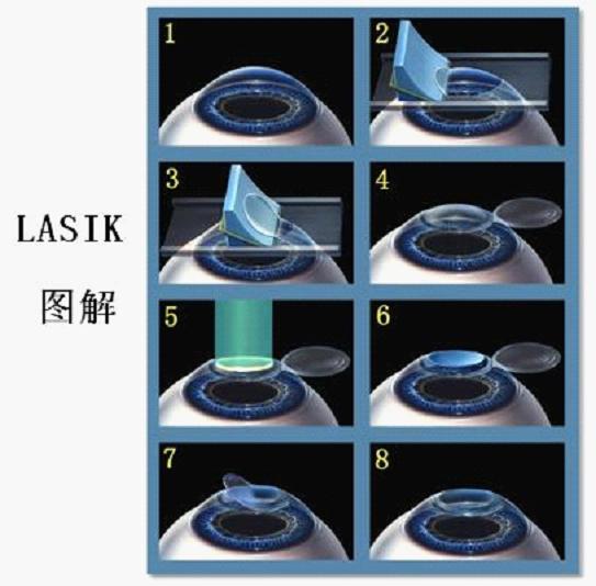 裂隙灯显微镜检查 - 就要健康网
